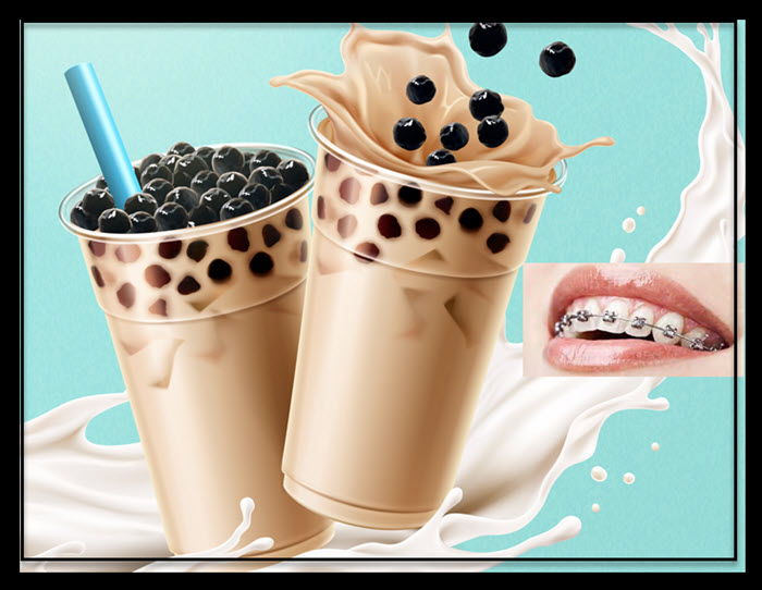 Can You Eat Boba With Braces 